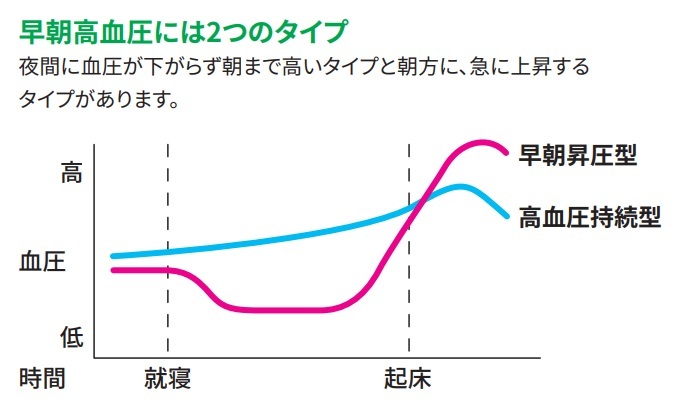 早期高血圧_image
