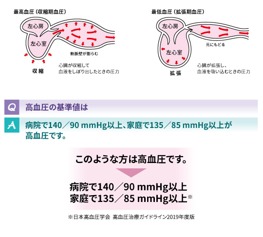 血圧Q&A_2-1